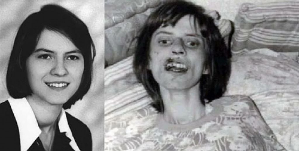 Anneliese Michel előtte és utána - a dramán változás