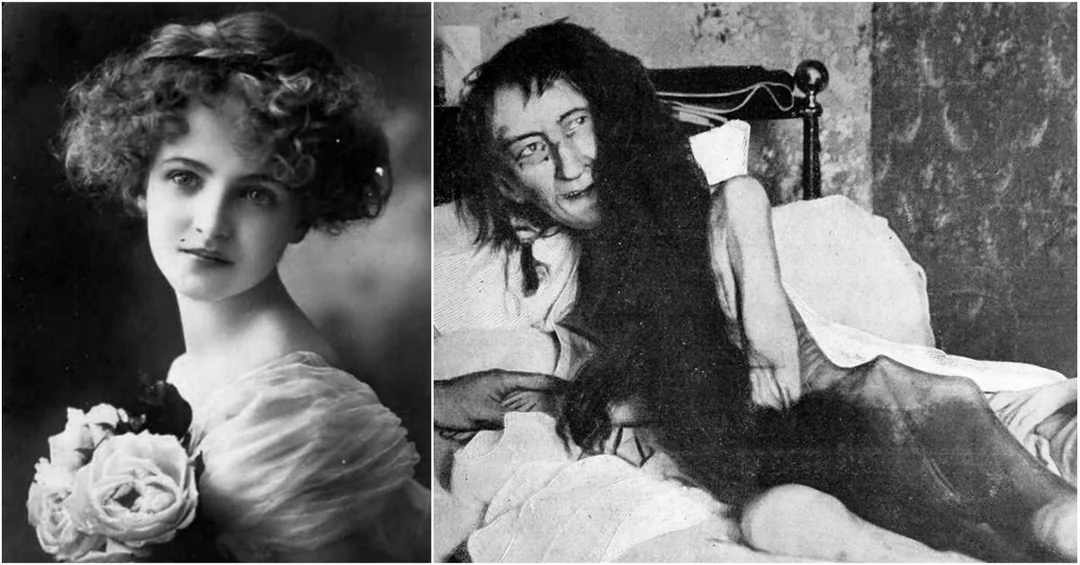 Blanche Monnier fiatalon és megtalálásakor - két kép egymás mellett